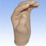 PROTEZA ZA AMPUTACIJU ŠAKE