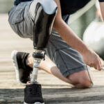 PROTEZA ZA POTKOLJENICU